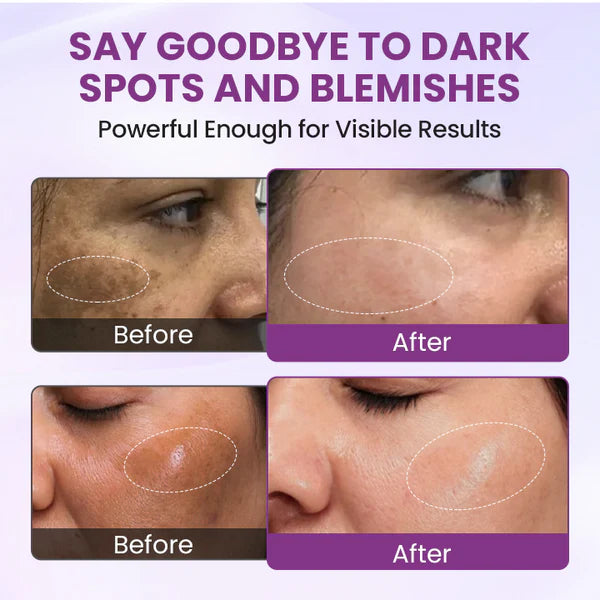 Biancat® RadiantClear Blemish & Brightening Serum